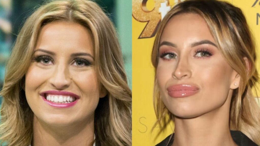 Ferne McCann’s Makeover Could Be Due to Plastic Surgery! houseandwhips.com