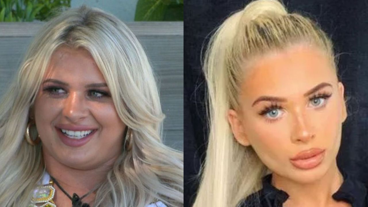 Examining Liberty Before and After Plastic Surgery Photos: Love Island Update! houseandwhips.com