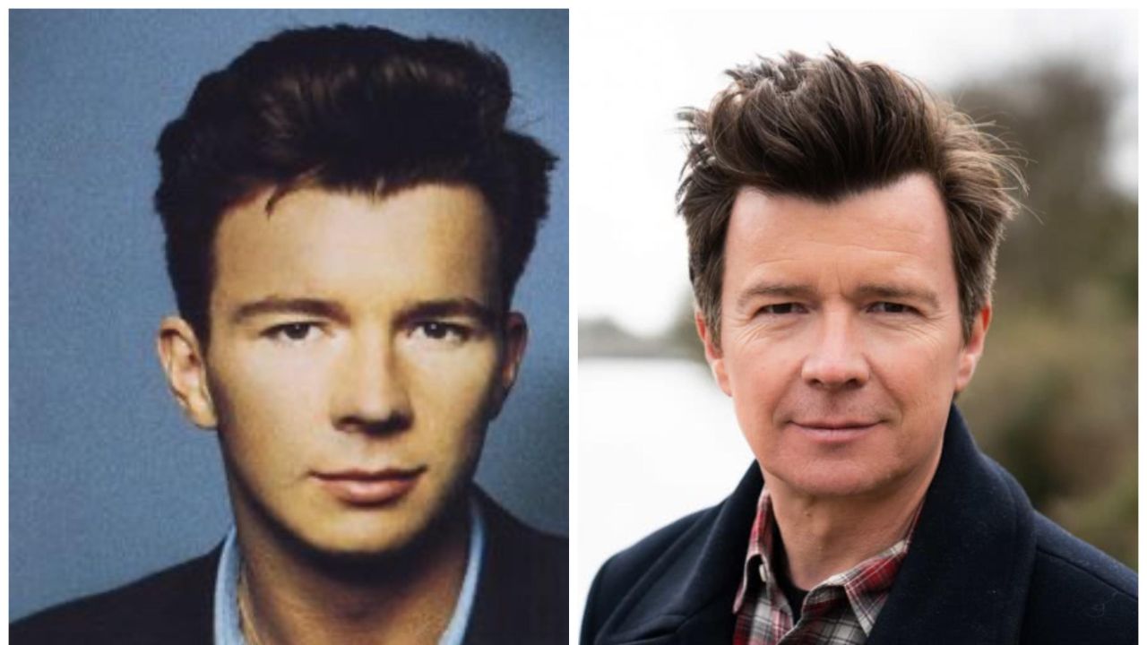 Rick Astley before and after plastic surgery. houseandwhips.com