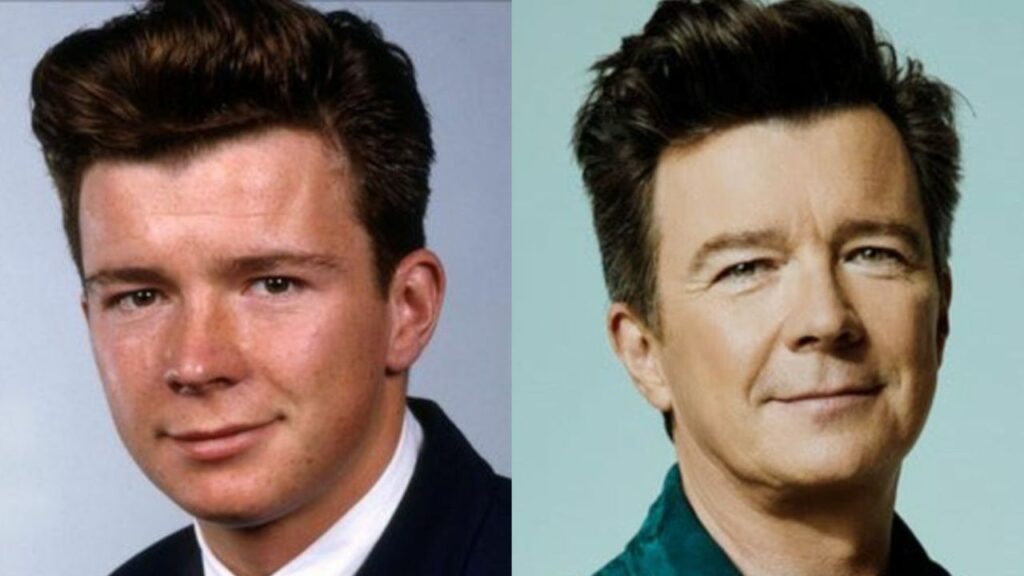 Rick Astley Received Plastic Surgery to Prevent Aging? houseandwhips.com