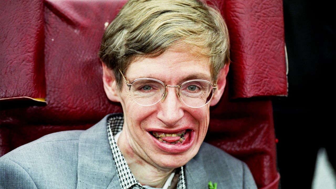 Stephen Hawking's teeth stuck out from his mouth. houseandwhips.com