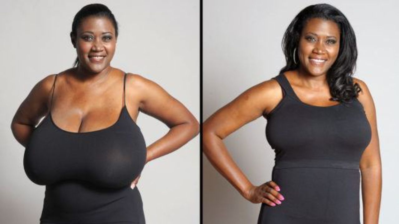 Many women feel more secure and comfortable in their bodies after getting their breasts reduced. houseandwhips.com
