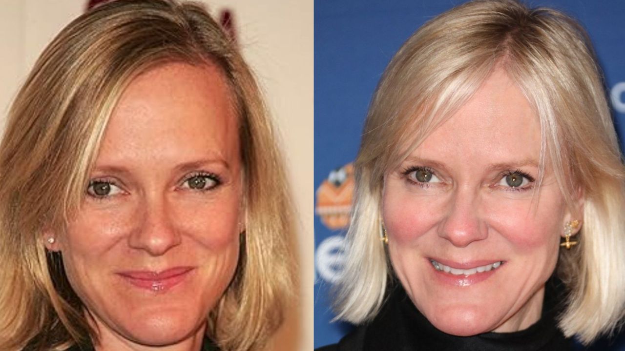 Hermione Norris Openly Admits to Receiving Plastic Surgery houseandwhips.com