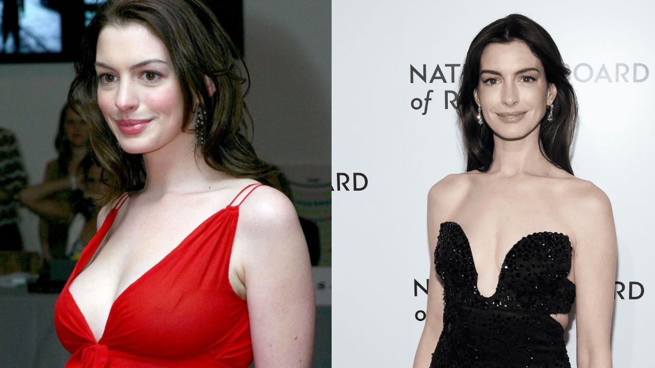 Anne Hathaway seems to have undergone a procedure to decrease the size of her breasts. houseandwhips.com