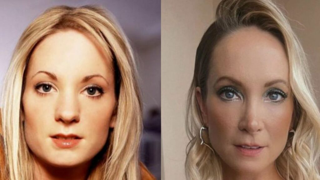 Joanne Froggatt Has Seemingly Fixed Her Nose Surgically! houseandwhips.com