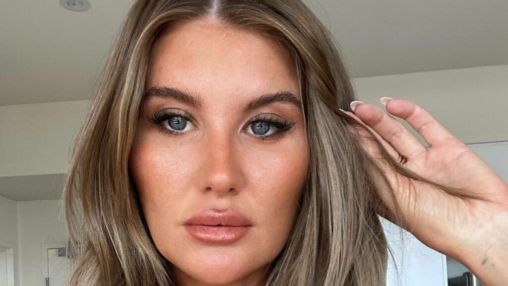 MAFS 2024 Lauren Plastic Surgery Before and After Pictures!