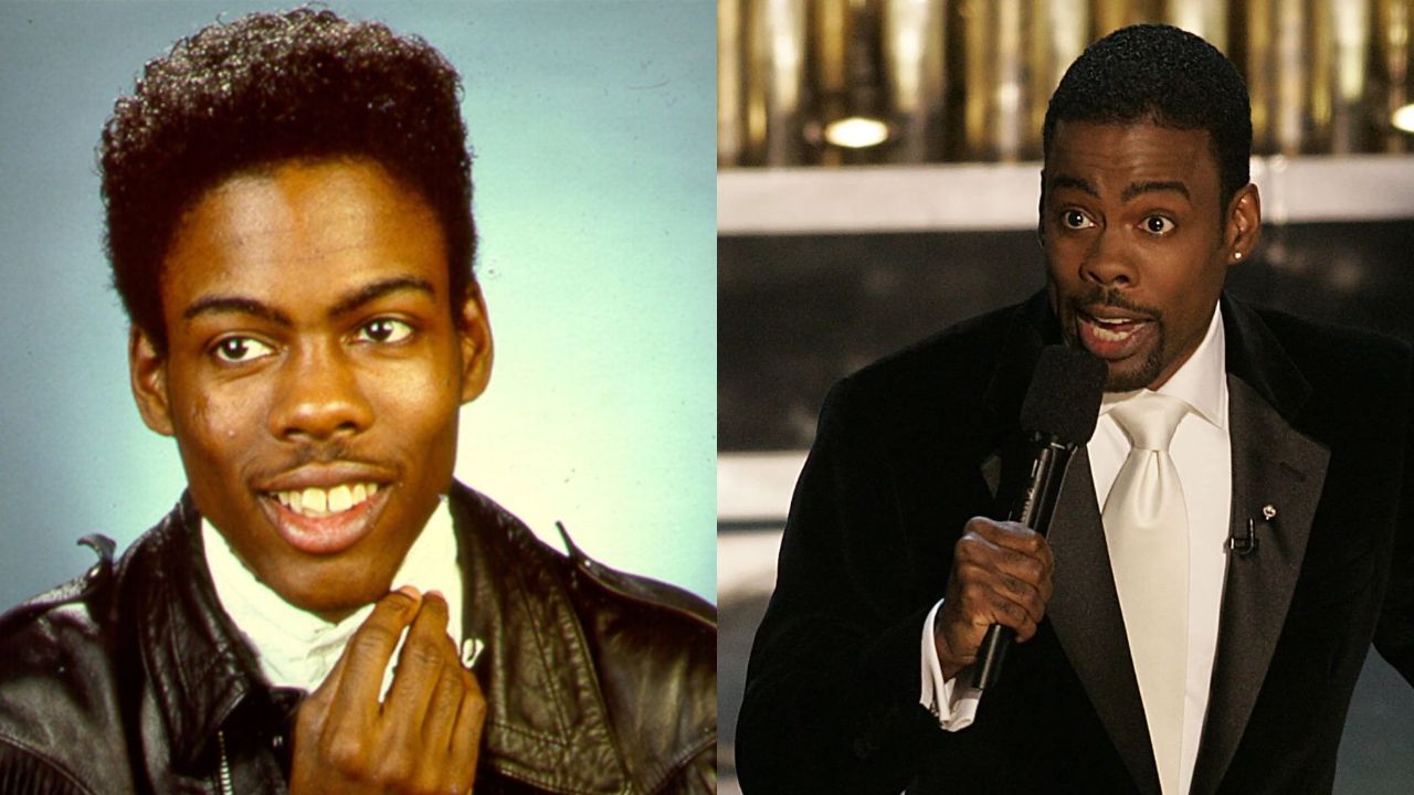 Chris Rock's Plastic Surgery: Before and After Face Surgery in 2022!