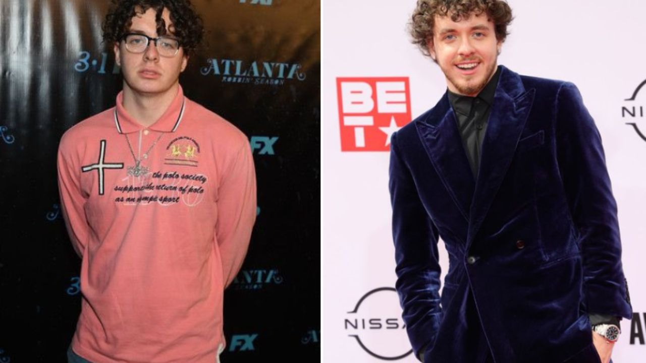 Jack Harlow's Plastic Surgery: Nose Job & Chin Fillers Inspected!