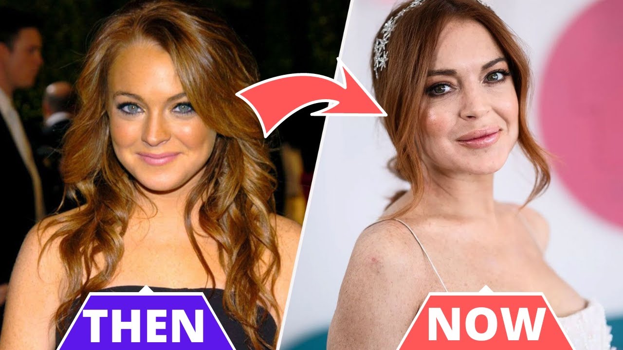 Lindsay Lohan's Plastic Surgery: Fillers, Nose Job, Eye Lift & More!