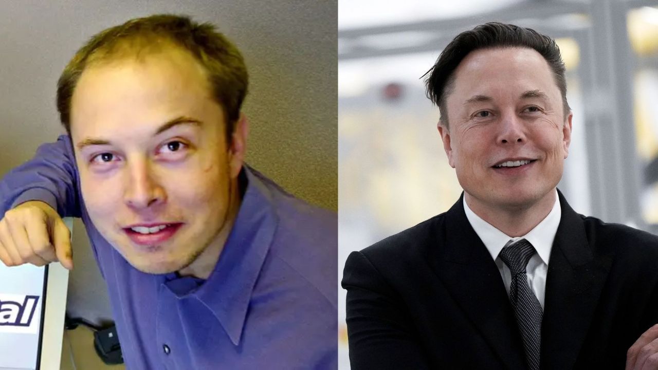 Elon Musk's Plastic Surgery: The New Twitter Owner Has Had Hair 