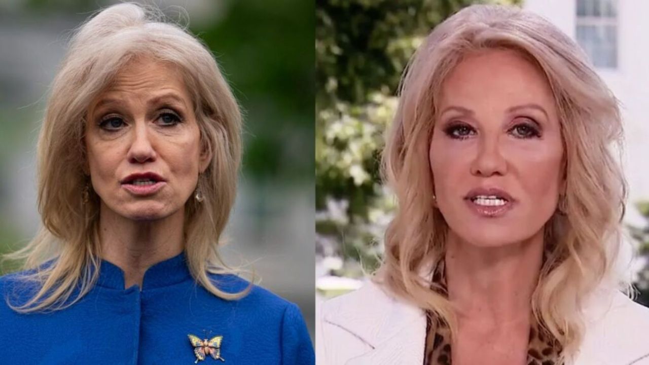 Kellyanne Conway's Plastic Surgery: Look At the Young Age Photos of The Senior Counselor to The Former President Donald Trump!
