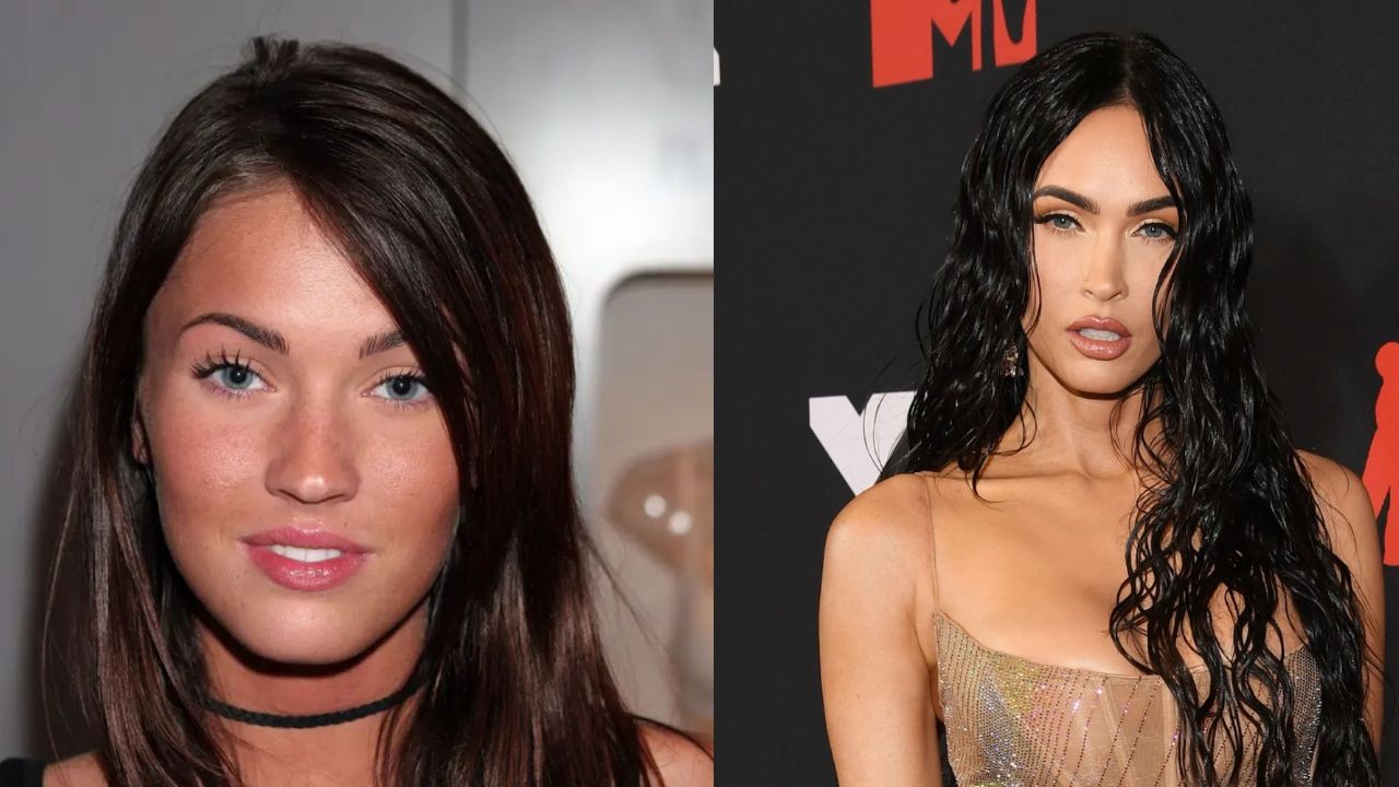 Megan Fox’s Plastic Surgery: The 36-Year-Old Star Looks as Young as Ever; Before and After Pictures Examined!
