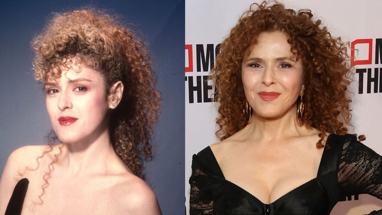 Bernadette Peters' Plastic Surgery: The Actress Does Not Look Her Age!