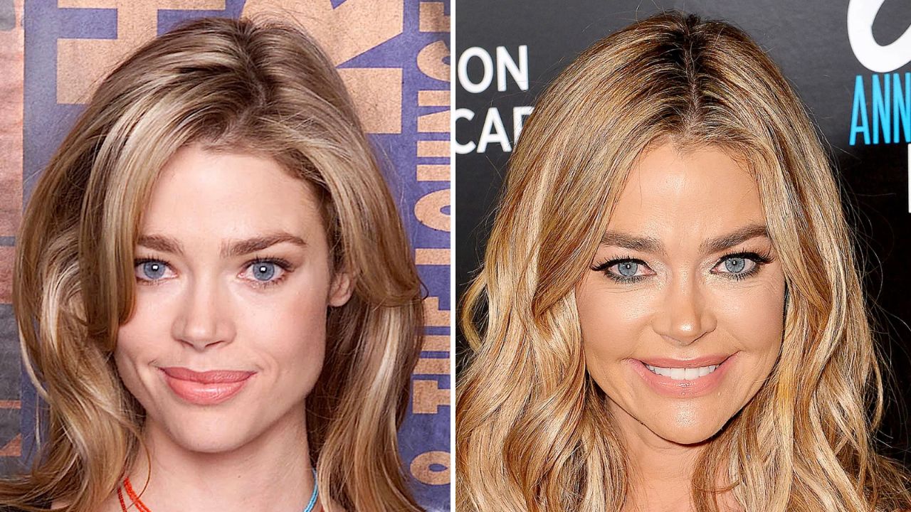 Denise Richards' Plastic Surgery: Did the Beverly Hills’ Housewife Dodge Aging by Going Under the Blades?