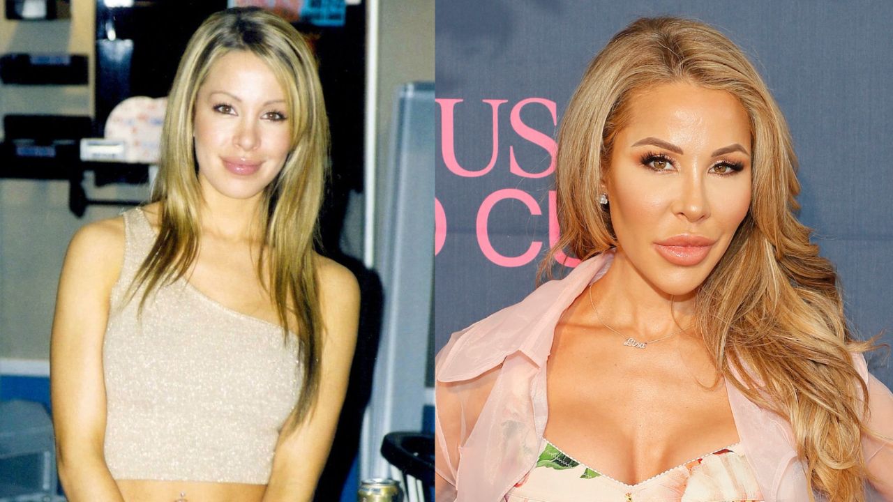Lisa Hochstein Before and After Plastic Surgery: The Real Housewives of Miami Star’s Transformation Explained!