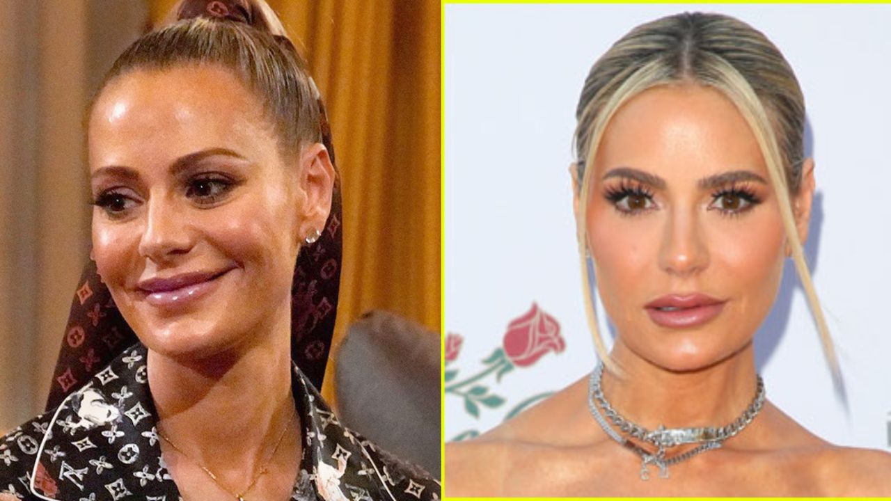 Dorit Kemsley Before Plastic Surgery: The Real Housewives of Beverly Hills’ Star’s Transformation!