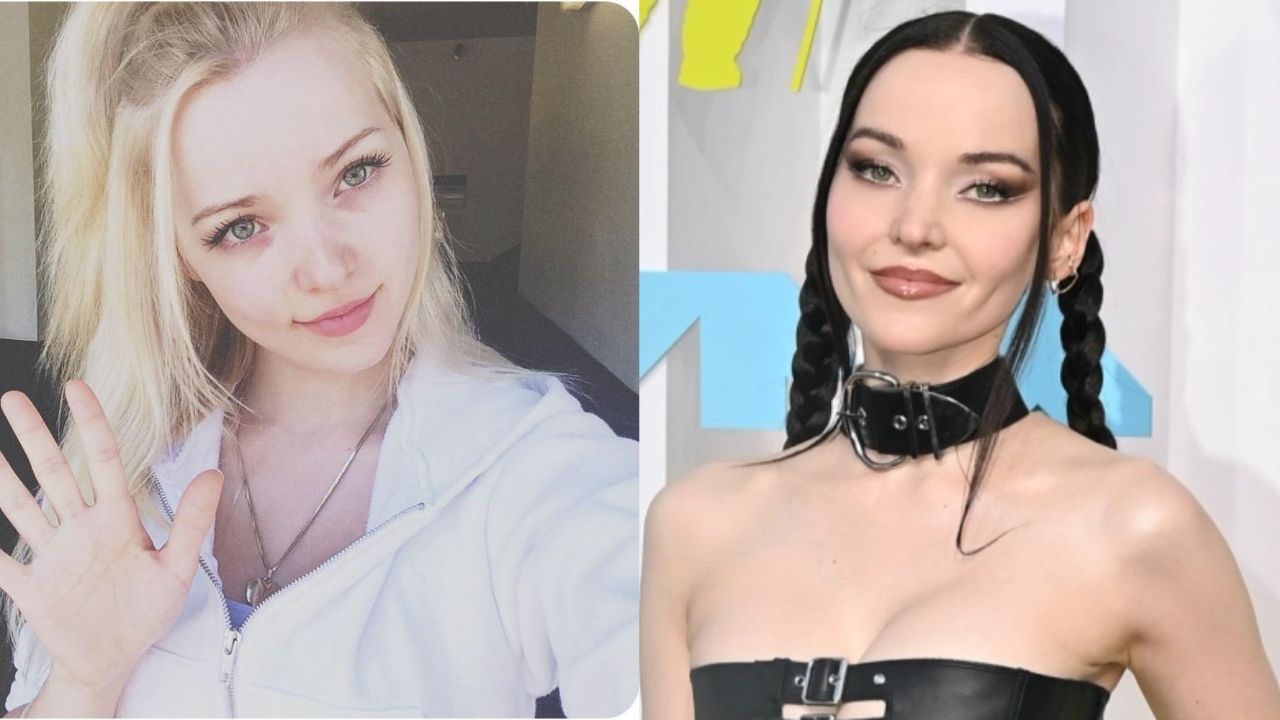 Dove Cameron's Plastic Surgery: Reddit Discussions About The Actress' Cosmetic Surgery!