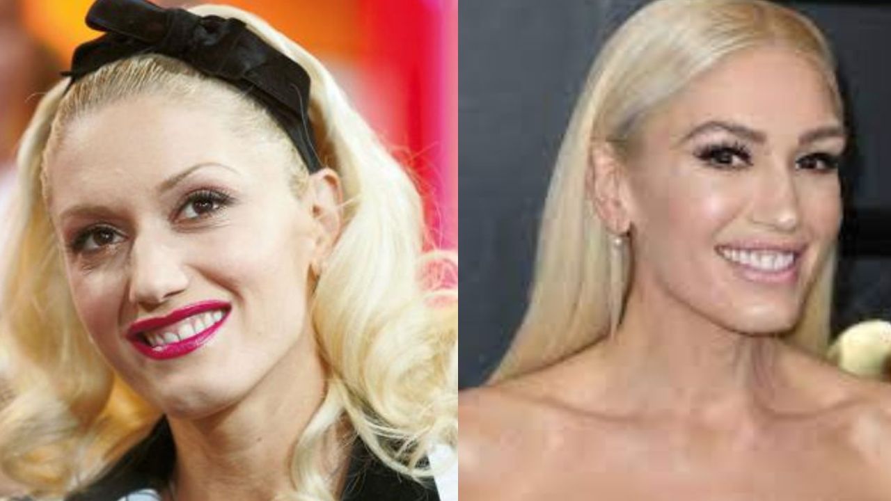 Gwen Stefani's Plastic Surgery: Reddit Discussions About Botox, Nose Job, and More; The Singer Then and Now!
