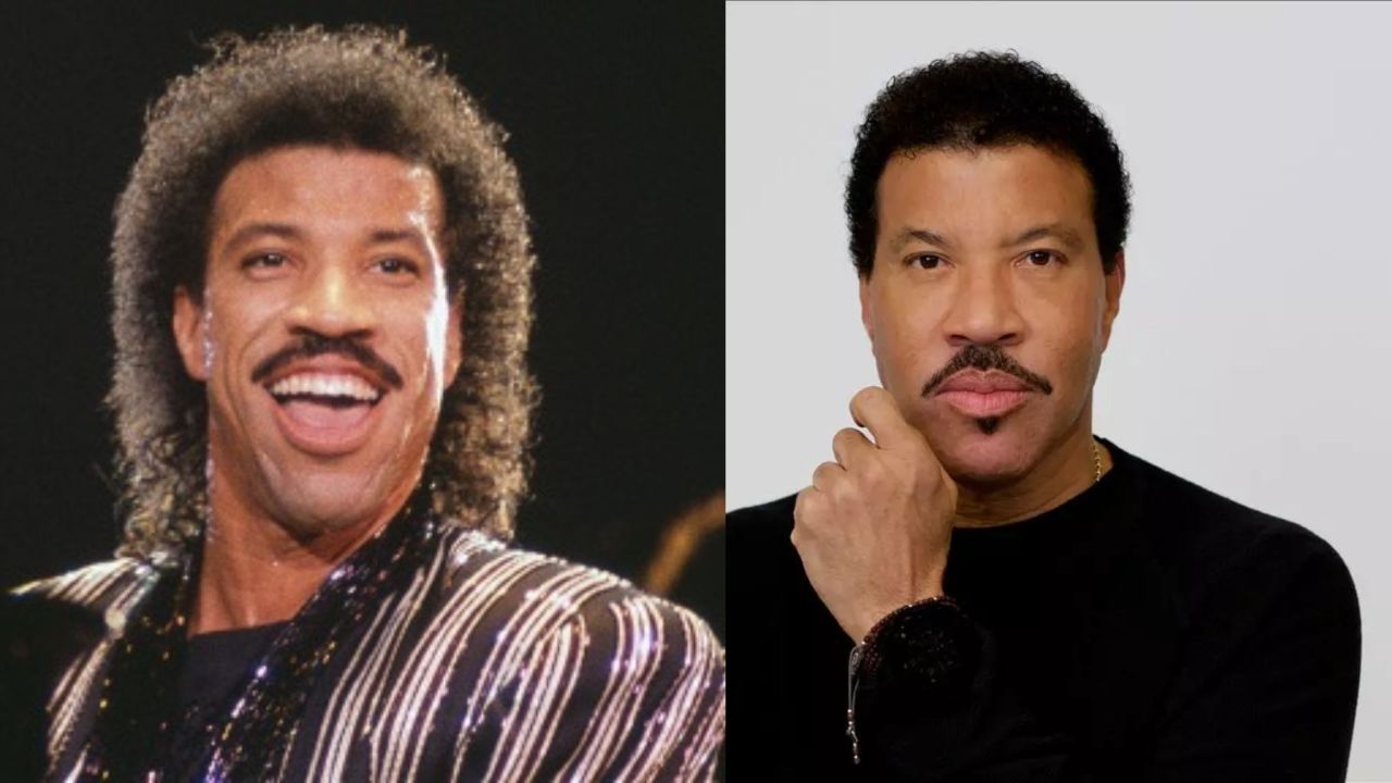 Lionel Richie's Plastic Surgery: The American Idol Judge Before and After Botox, Facelift and Hair Transplant!