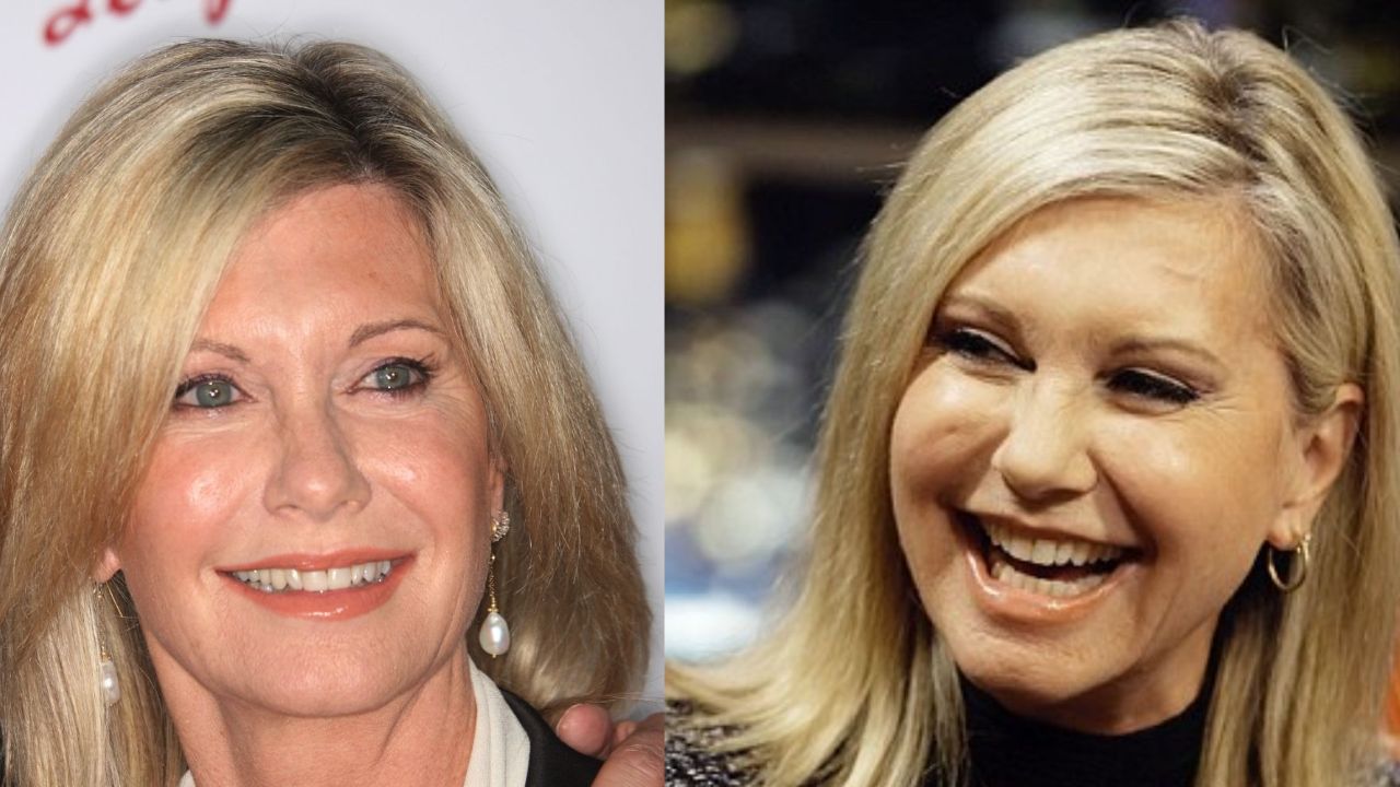 Olivia Newton-John's Plastic Surgery: Did The Actress Get Botox and Fillers? Fans Seek Before and After Pictures!
