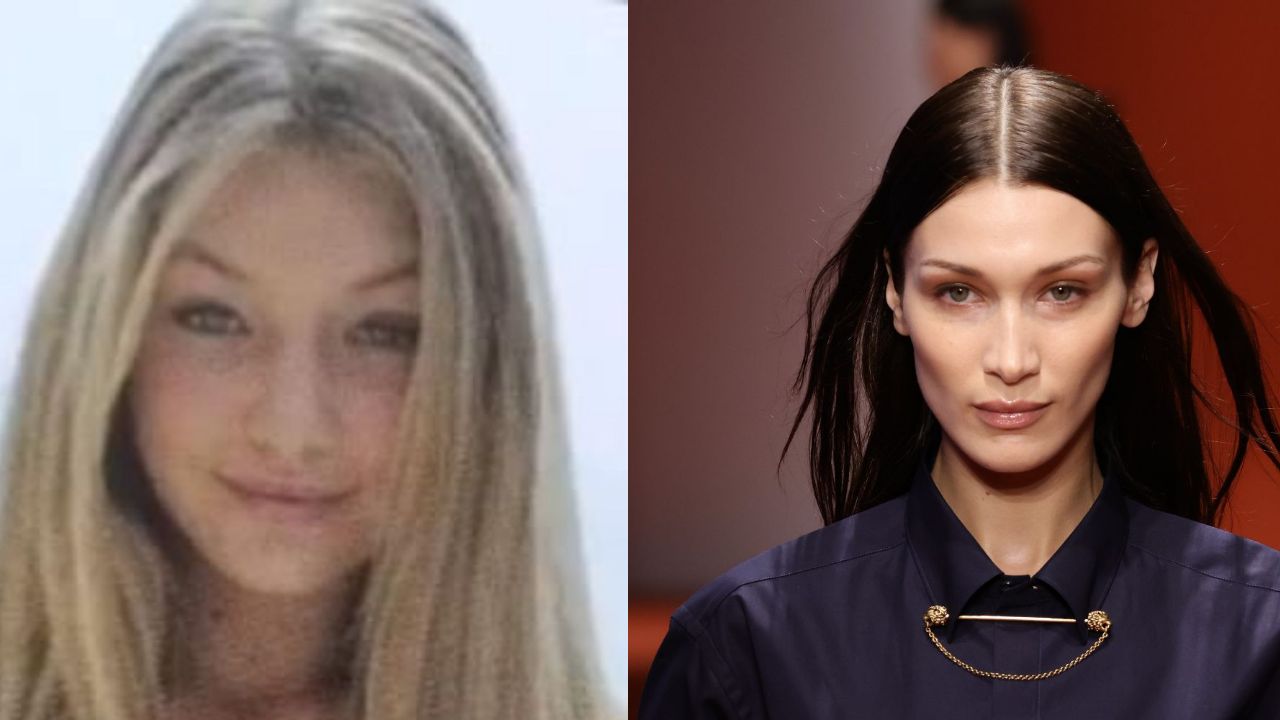 Bella Hadid’s Plastic Surgery Inspiration: Admitted to Nose Job in Vogue Interview; Fans Suspect Facelift & Eye Lift!