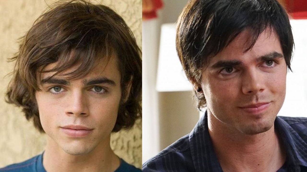 Reid Ewing Plastic Surgery 2022: Why Did the Modern Family Cast Go Under the Knife? Before & After Pictures Analyzed!