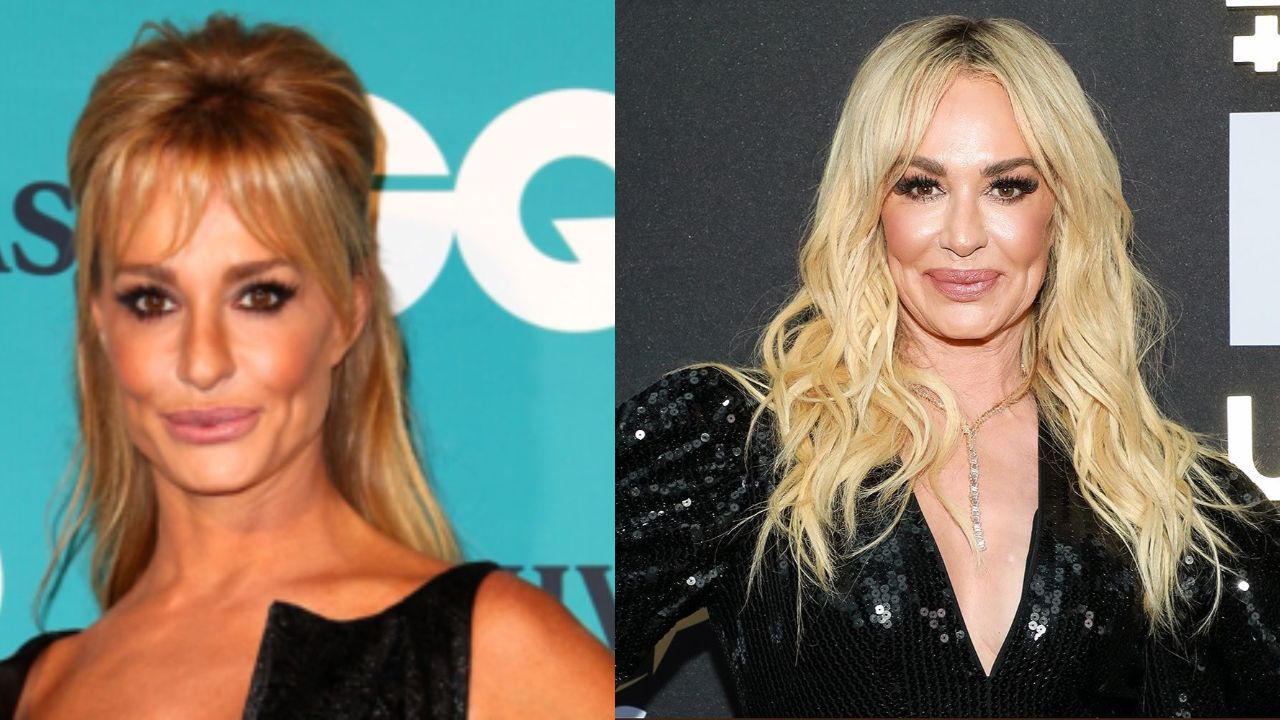 Taylor Armstrong's Plastic Surgery: Has The Former Real Housewives of Beverly Hills Star Gone Under the Knife? Check out the Before and After Pictures!
