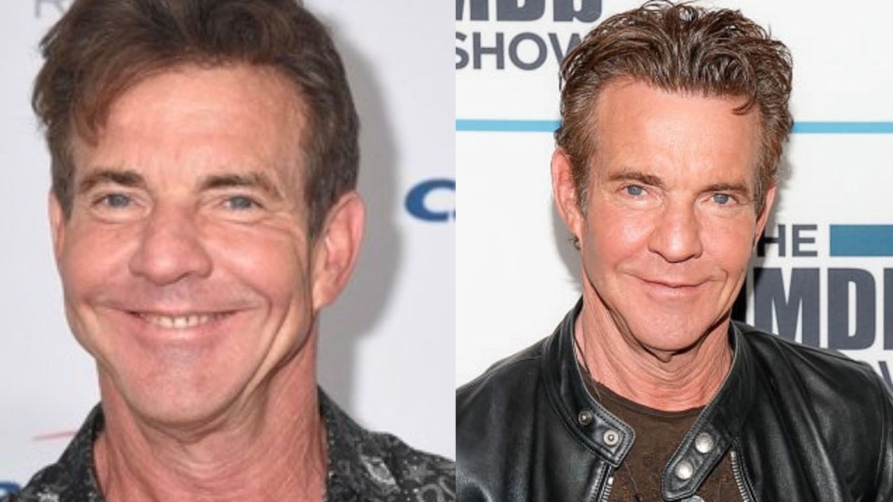 Dennis Quaid's Plastic Surgery: The Blue Miracle Star Got Cosmetic Works Done to Look Young; The Actor Then and Now!
