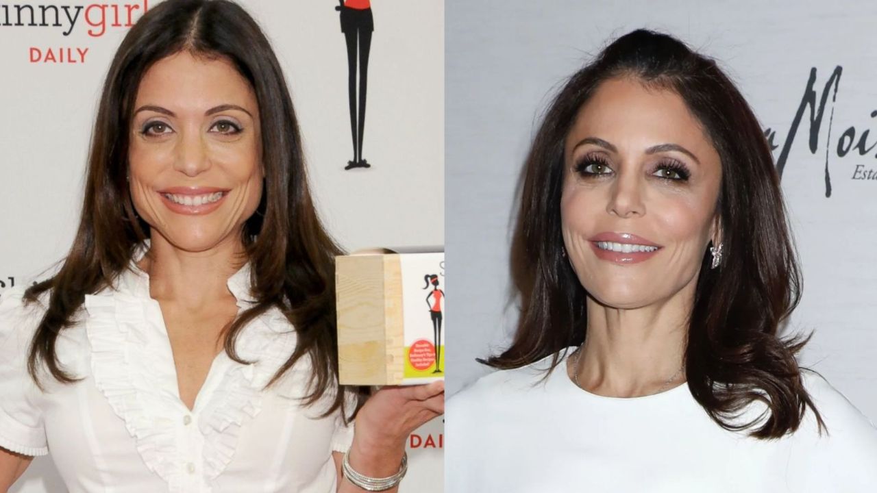 Bethenny Frankel's Plastic Surgery: The Former Real Housewives of New York City Has Been Very Open About The Cosmetic Procedures She Has Had!
