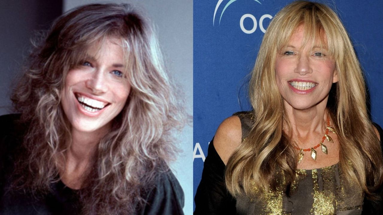 Carly Simon’s Plastic Surgery: What Does She Look Like Now?