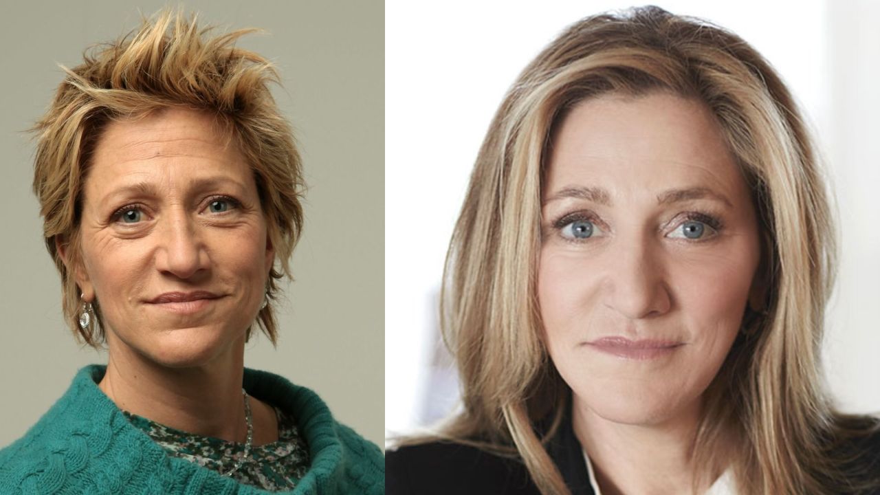 Edie Falco's Plastic Surgery: Did The Avatar Cast Have Botox and a Facelift?