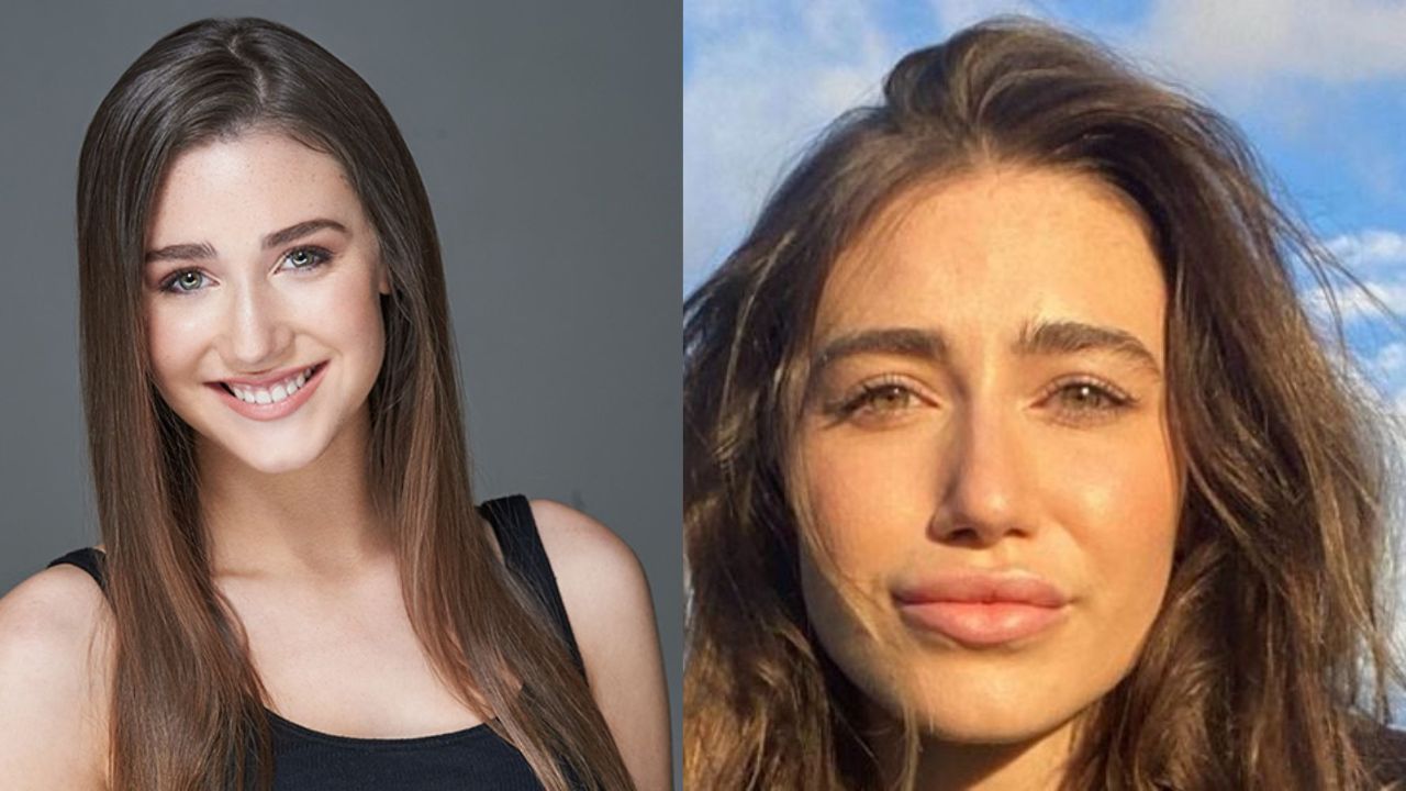 Kamilla Kowal's Plastic Surgery: Has The Bonnie McMurray Actress from Letterkenny Had Lip Fillers and a Nose Job?