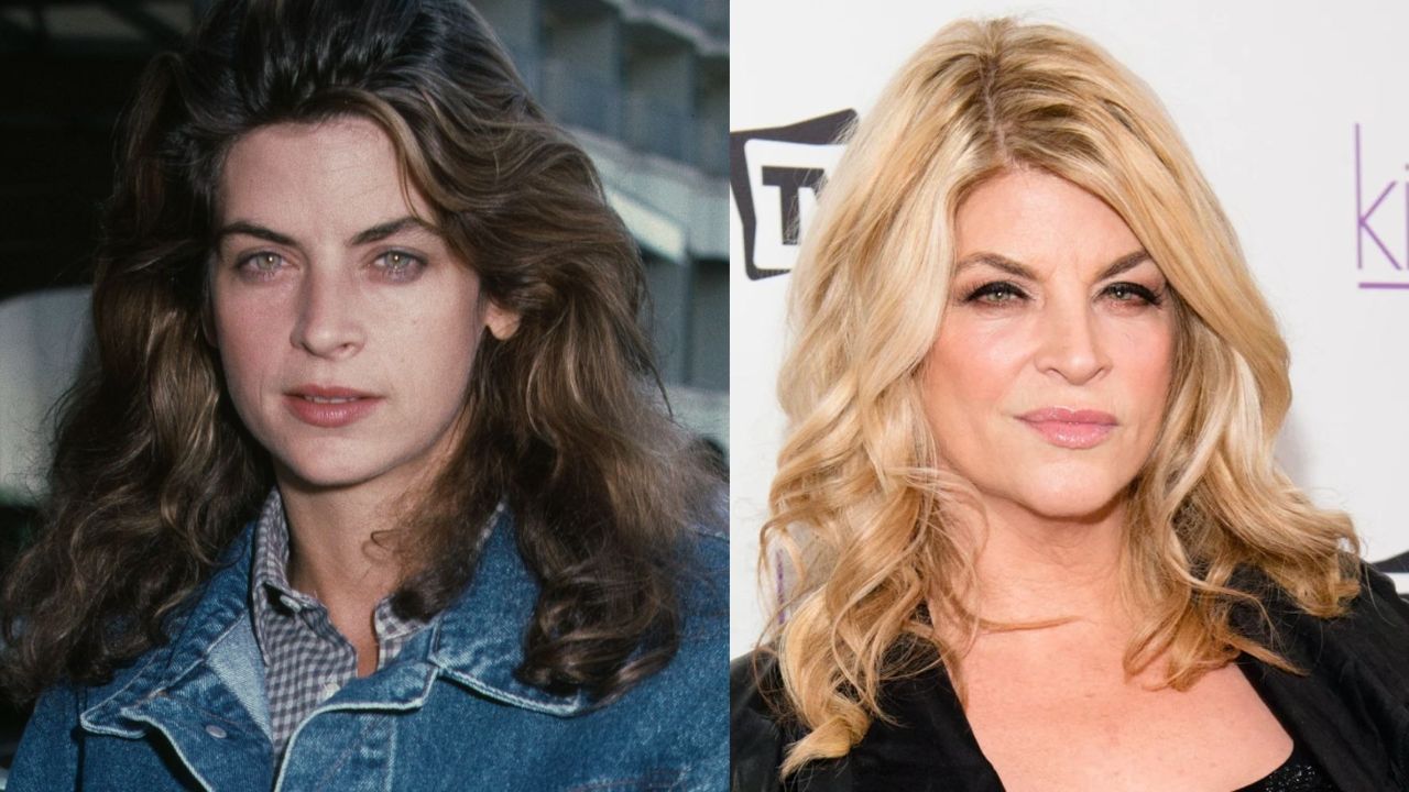 Kirstie Alley's Plastic Surgery: Did The Cheers Star Have Botox and a Facelift?