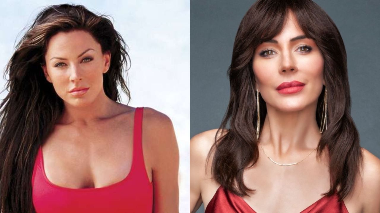 Krista Allen's Plastic Surgery: Taylor From The Bold and The Beautiful Had Mohs Surgery to Get Rid of Skin Cancer! The Actress Then and Now!