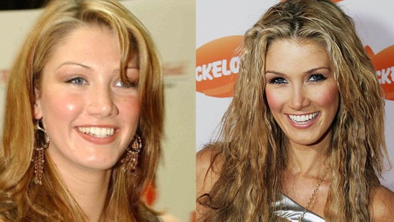 Delta Goodrem’s Plastic Surgery in 2023: Looking at Her No Makeup Pictures, the 38-Year-Old Actress Doesn’t Look Natural!