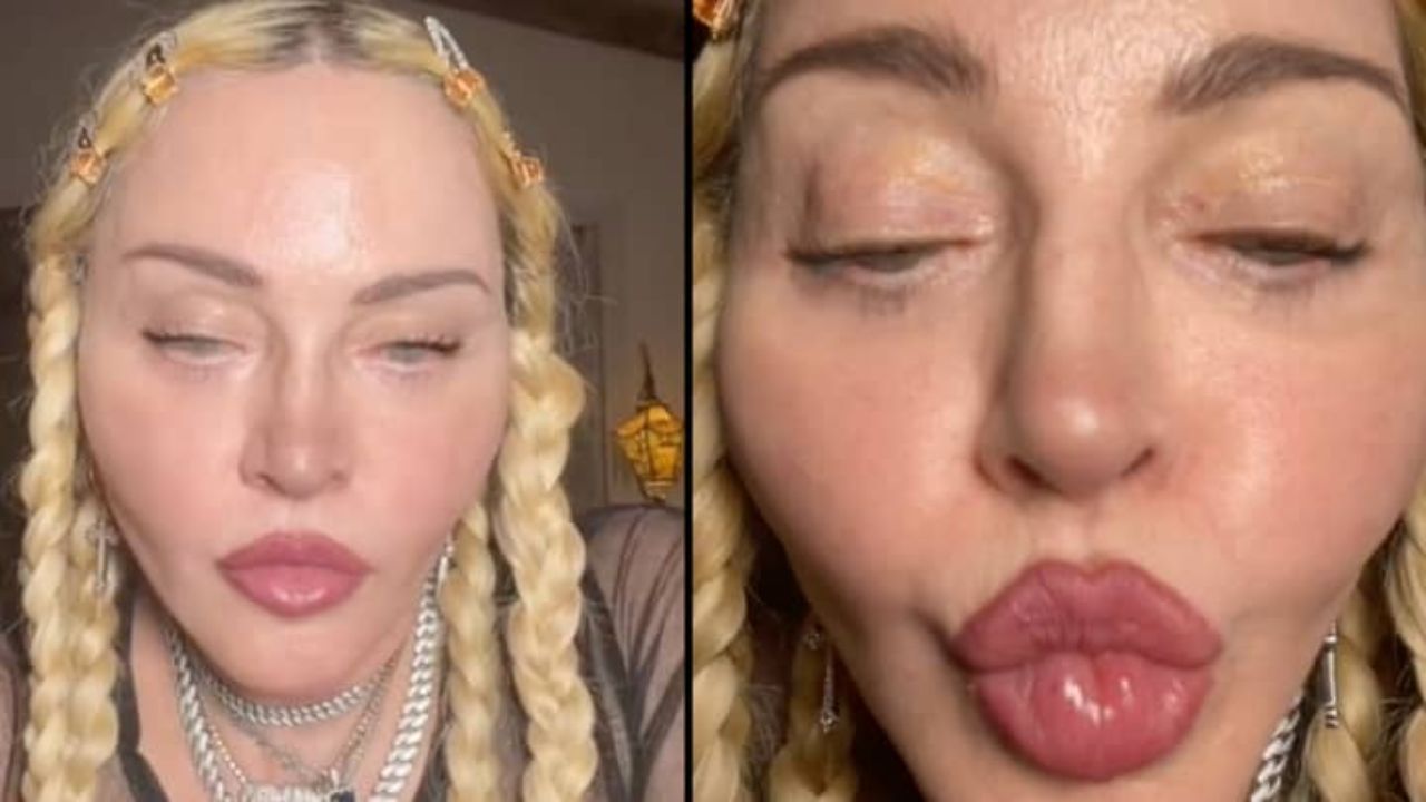 Madonna's Plastic Surgery: A Tiktok Video of The Singer Described as Unsettling Sparked Cosmetic Surgery Rumors!