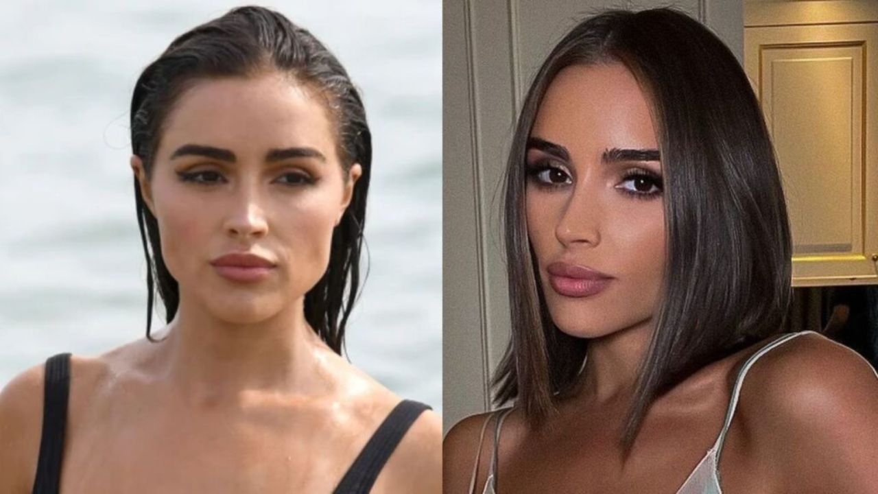 Olivia Culpo’s Plastic Surgery: What Are the Beauty Secrets of the Former Miss Universe? Before & After Pictures Examined!