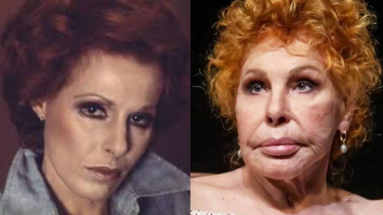 Ornella Vanoni's Plastic Surgery: What Happened to the 7 Women and a Murder Cast Member's Face? How Did She Look When She Was Young?