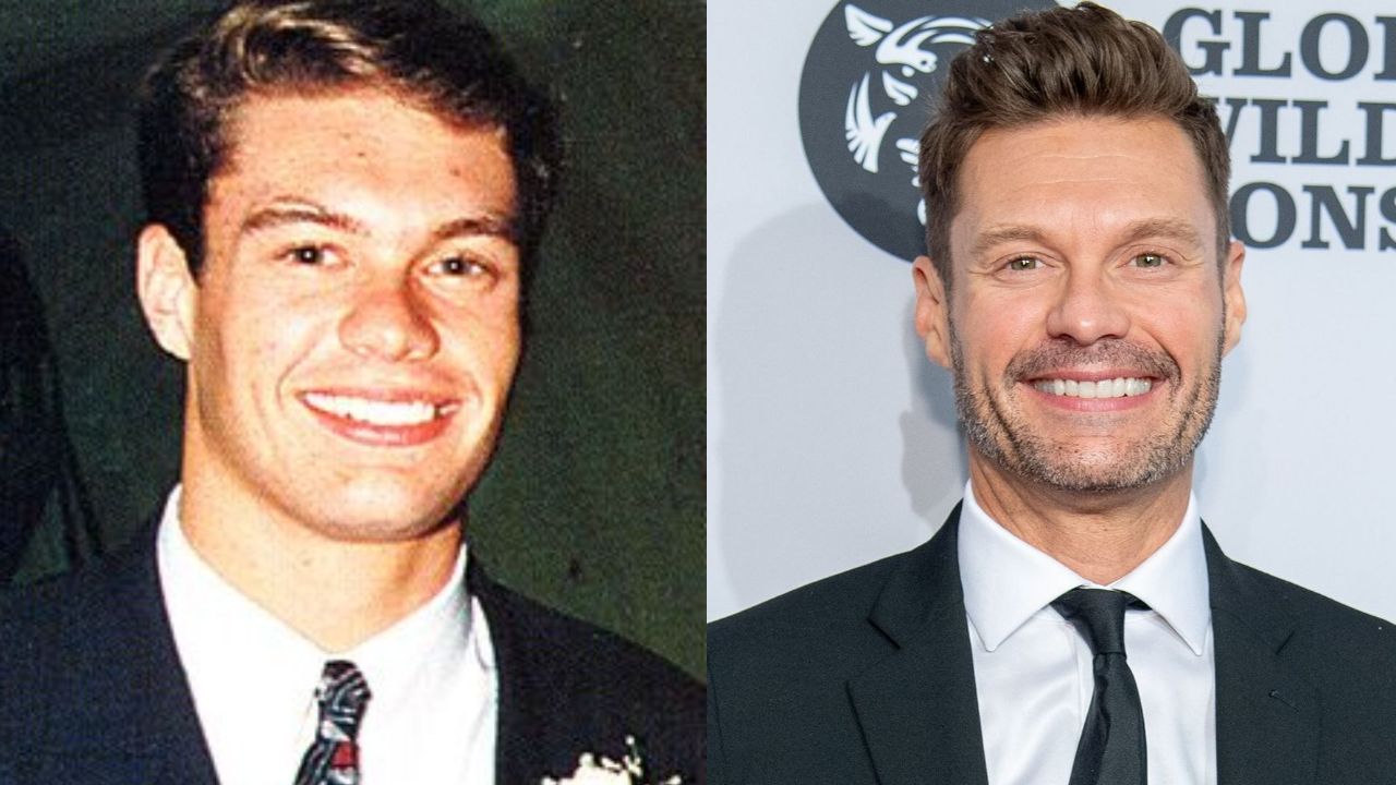 Ryan Seacrest's Plastic Surgery: Has The Television Show Host Had Cosmetic Surgery? The Media Personality Then and Now!