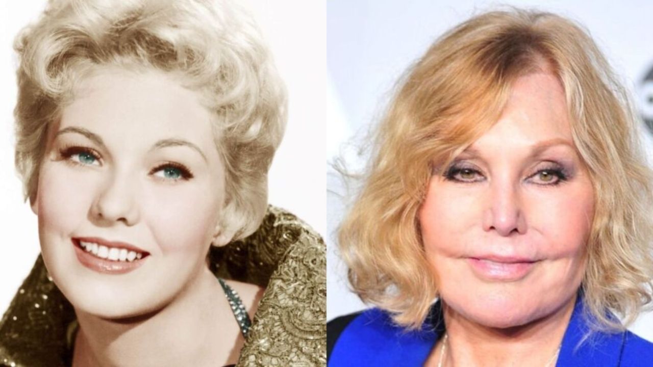 Kim Novak’s Facelift: The 90-Year-Old Actress Didn’t Really Like How Her Face Turned Into After the Procedure!