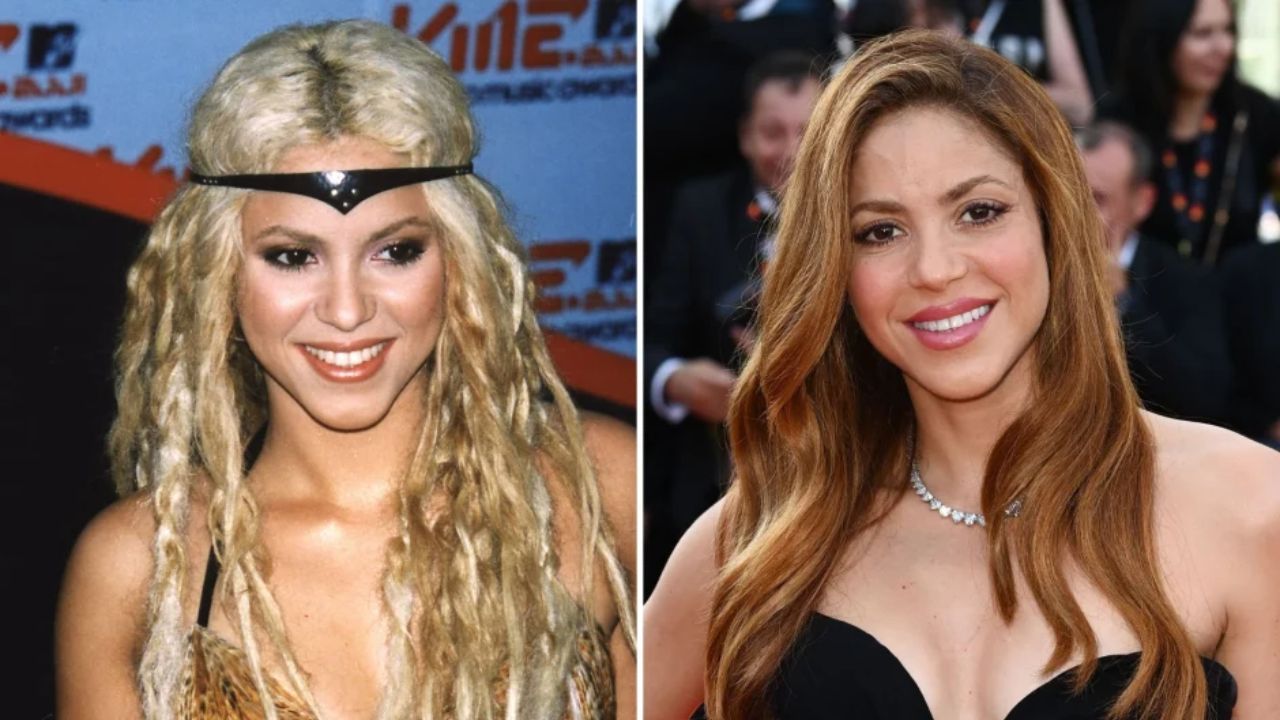 Shakira’s Plastic Surgery: Is the Queen of Latin Music Suffering From Heartbreak? Reddit Speculates!