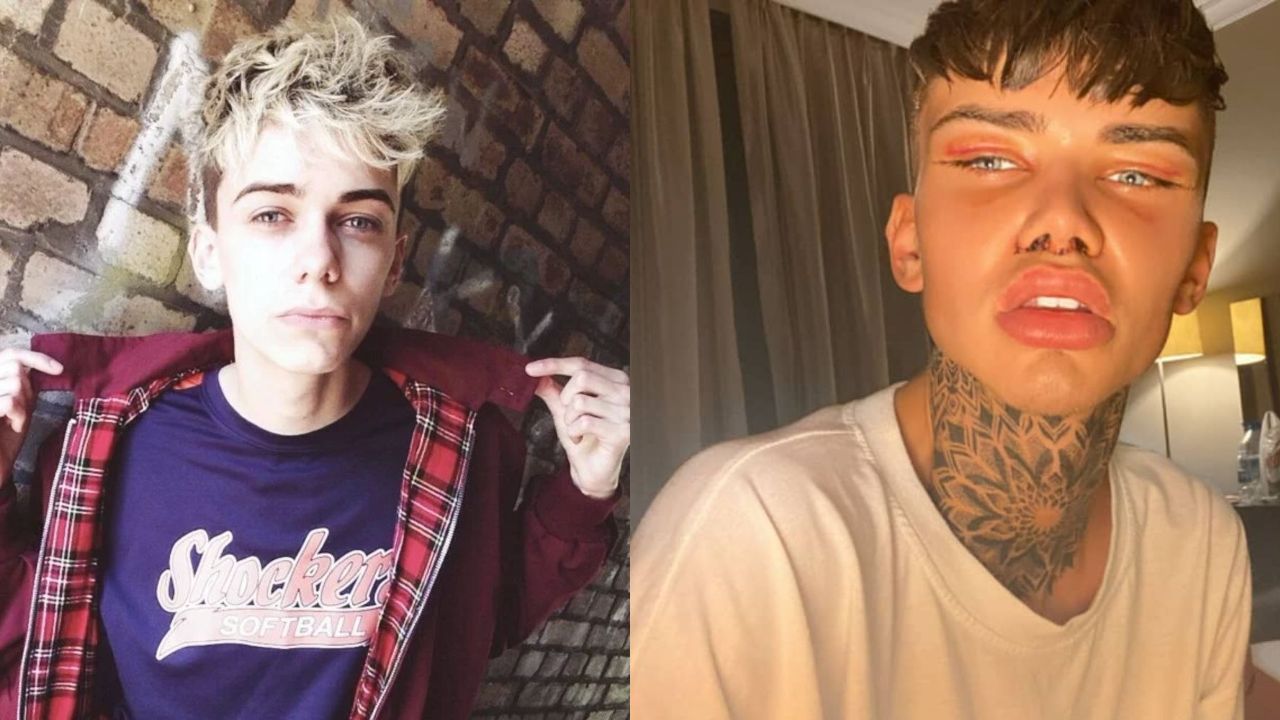 Levi Jed Murphy Before Plastic Surgery: He Didn't Resemble Handsome Squidward or Purge's Smile Mask!