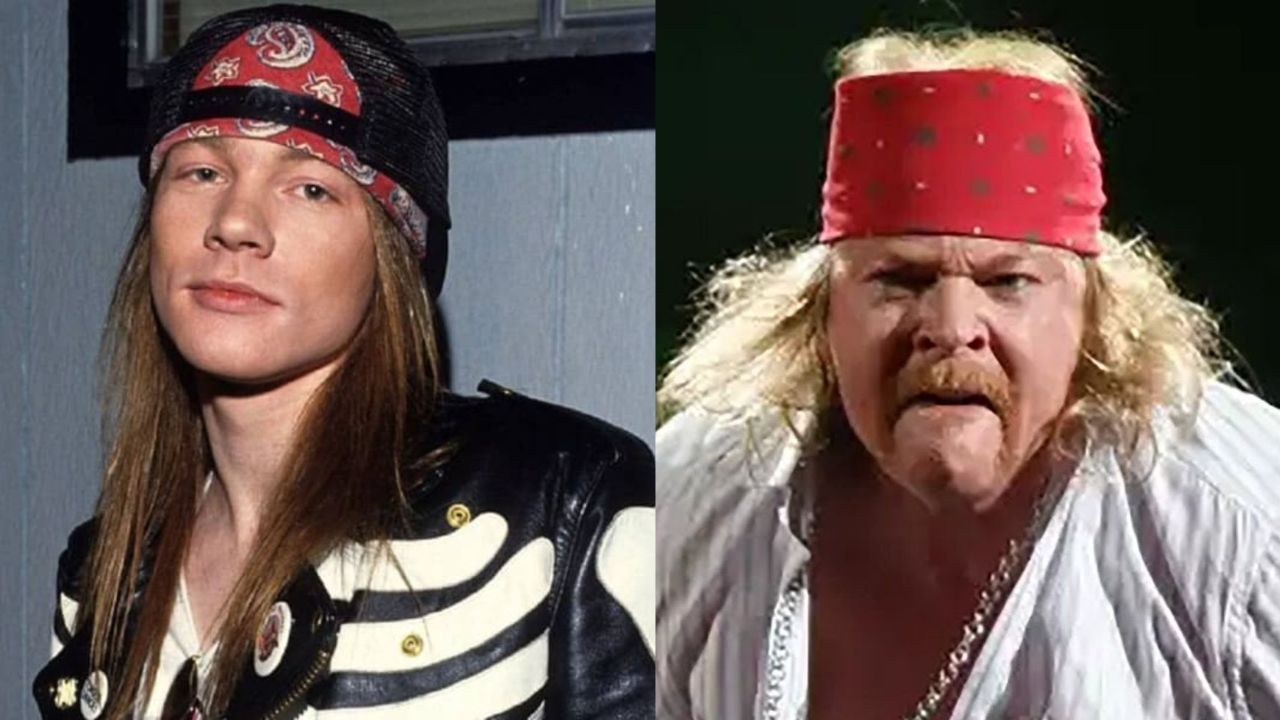 Axl Rose’s Plastic Surgery: The Guns N’ Roses Star Looks Unnatural! houseandwhips.com