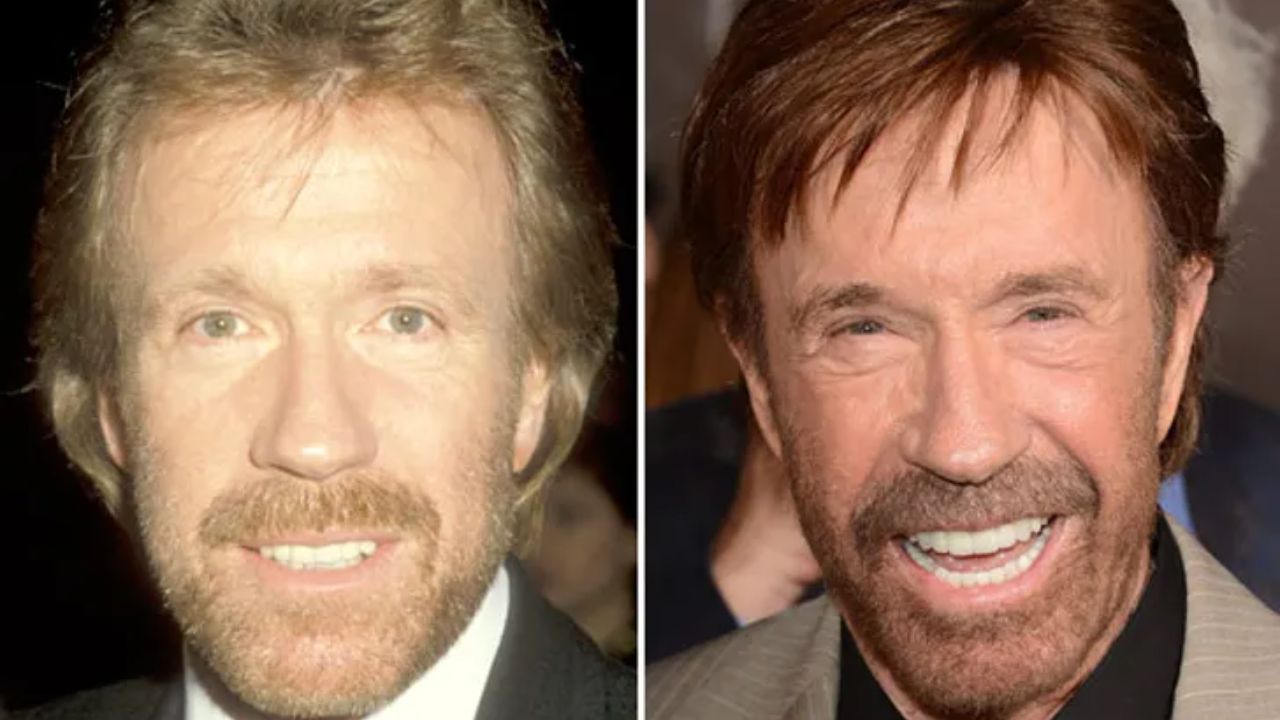Chuck Norris before and after plastic surgery. houseandwhips.com