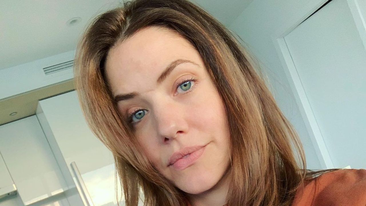 Julie Gonzalo’s Scar: Birth Mark or What? houseandwhips.com