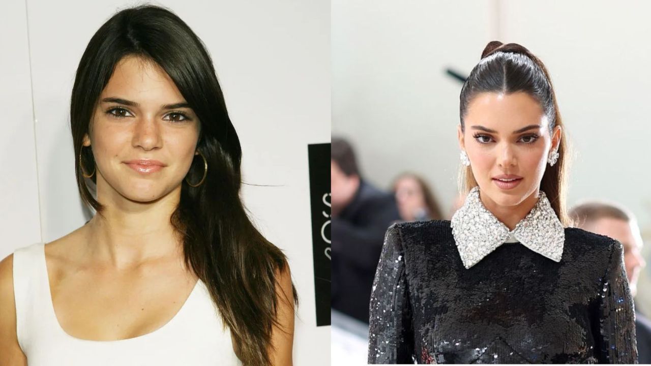 Reddit Discusses Kendall Jenner’s Plastic Surgery! houseandwhips.com