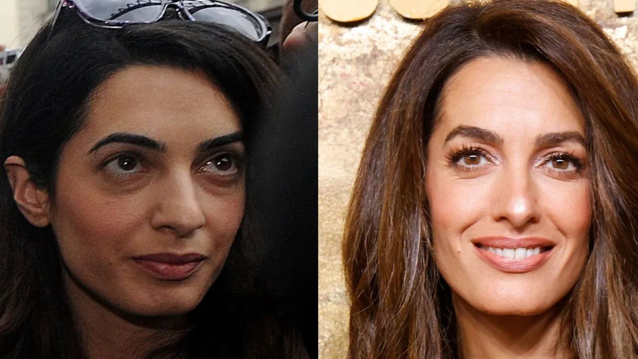 Is Plastic Surgery the Reason Behind Amal Clooney’s Beauty?