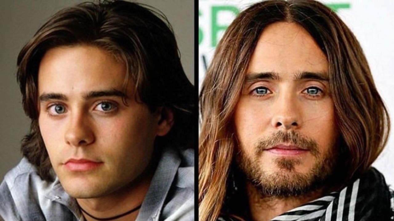 Jared Leto before and after plastic surgery. houseandwhips.com 