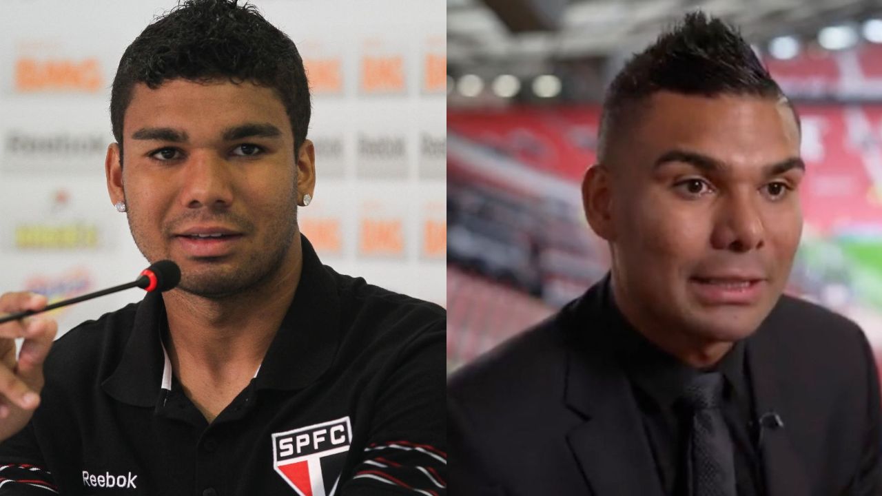 Casemiro's nose job hasn't gone too well for him. houseandwhips.com