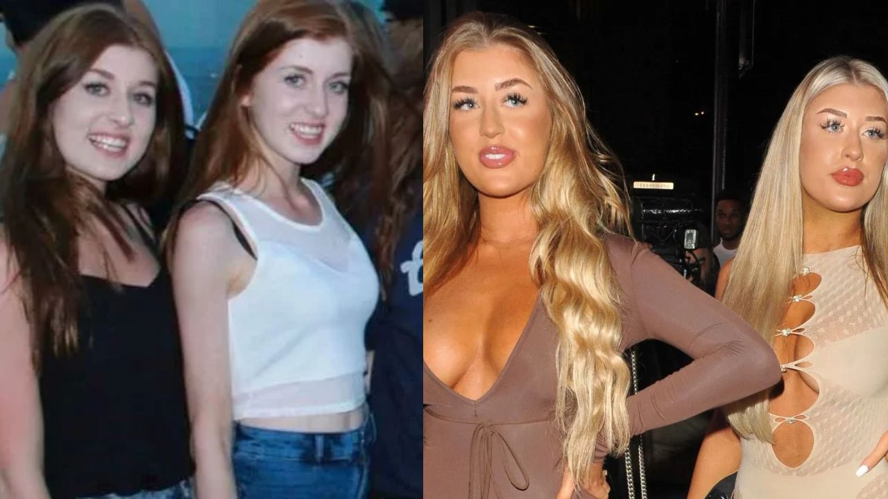 Jess and Eve's fillers and nose job is obvious from her before and after comparison pictures. houseandwhips.com